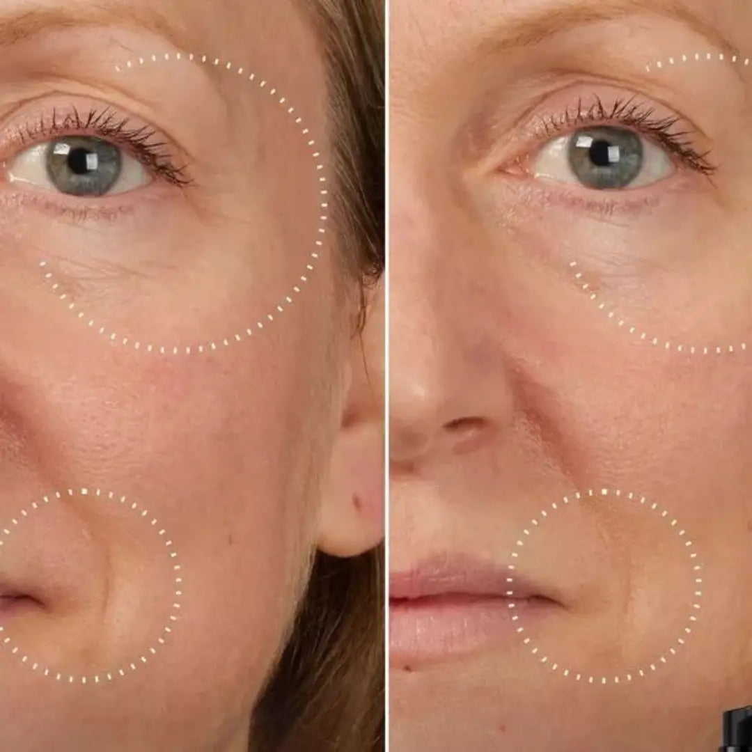 SkinLift™ | Botox Serum | “93% yngre hud på 14 dagar – bevisat av Glow Science Lab™.