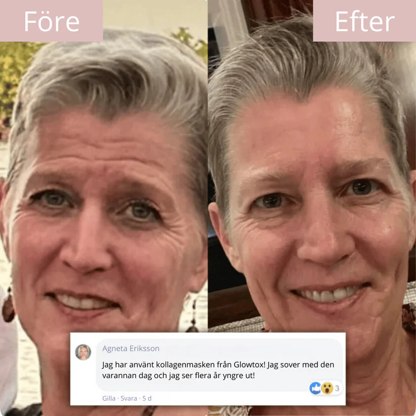 93% vaknade yngre redan första natten – Glowtox™: Mirakelmasken som säljer slut varje vecka.