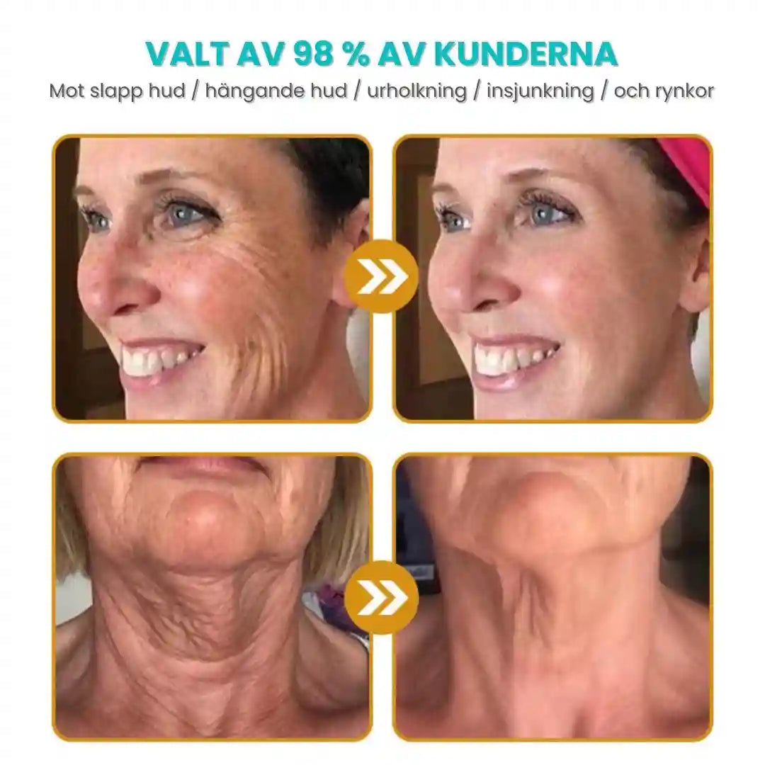 Anti-Wrinkle™ | 96% slätare hud på bara 14 dagar! DERMIQUE