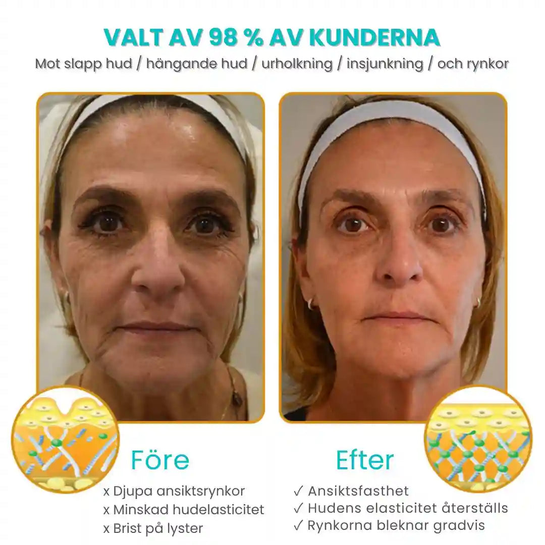 Anti-Wrinkle™ | 96% slätare hud på bara 14 dagar! DERMIQUE