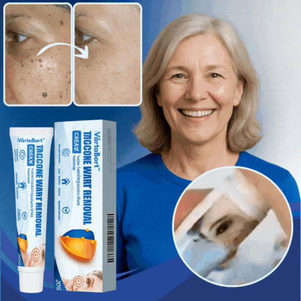 VårtaBort™ | Ta bort vårtor, hudfläckar och knölar på bara 7 dagar!