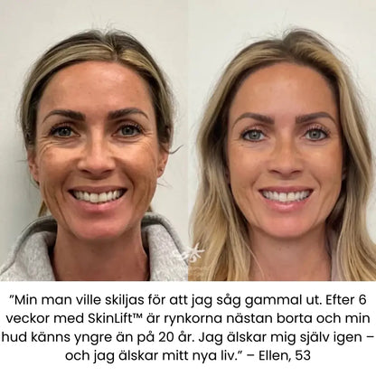 SkinLift™ | Botox Serum | “93% yngre hud på 14 dagar – bevisat av Glow Science Lab™.