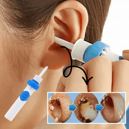 Avlägsna öronvax skonsamt med mjuk sugkraft på bara 60 sekunder!