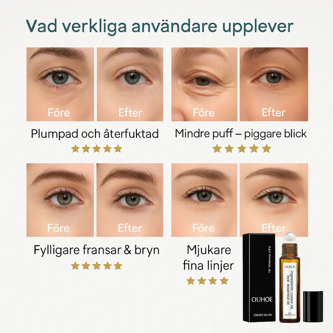 8 år yngre på bara några sekunder – strålande, ungdomliga ögon utan injektioner.