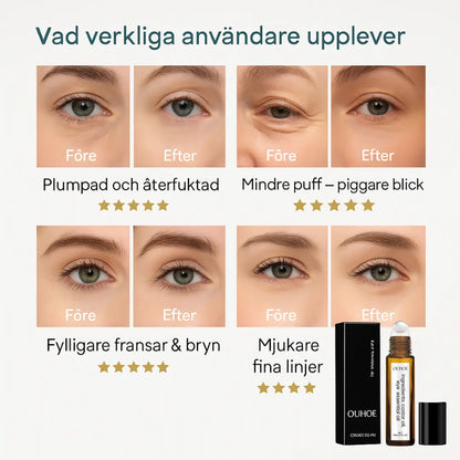 8 år yngre på bara några sekunder – strålande, ungdomliga ögon utan injektioner.