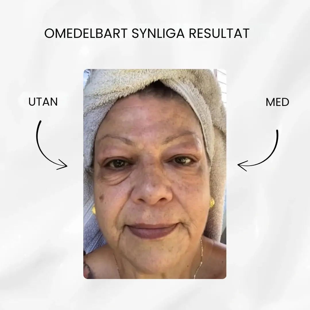 V-Lift ögonkräm – 10 år yngre på mindre än 7 minuter.  Se omedelbart fastare ut.