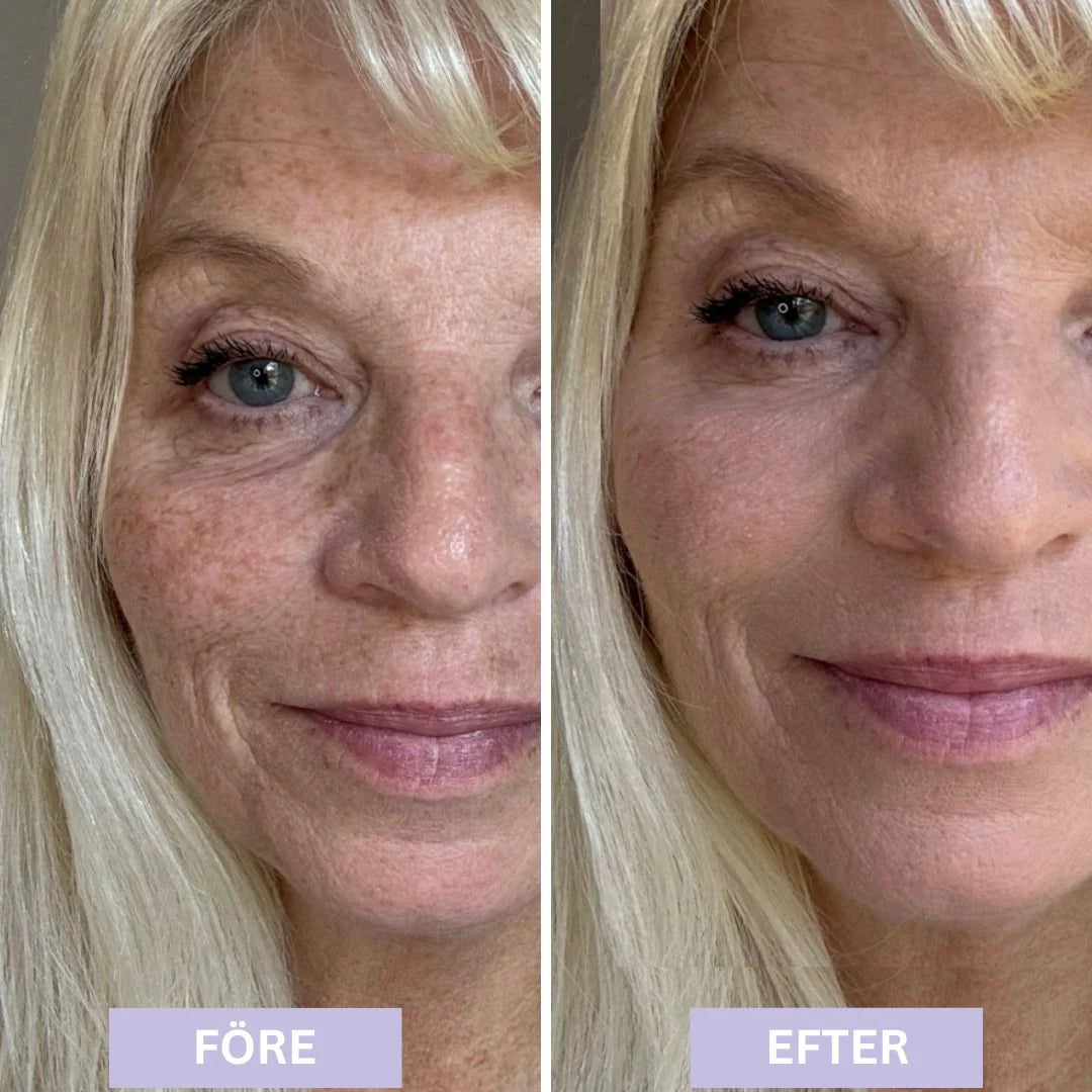 93% såg yngre hud och fick tillbaka komplimangerna de trodde var borta – Luméra™ dämpar rynkor och suddar porer på sekunder.