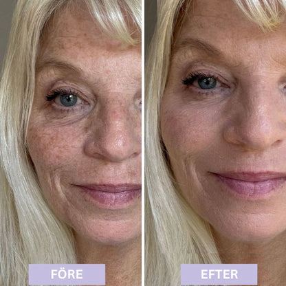 93% såg yngre hud och fick tillbaka komplimangerna de trodde var borta – Luméra™ dämpar rynkor och suddar porer på sekunder.