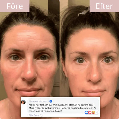 93% vaknade yngre redan första natten – Glowtox™: Mirakelmasken som säljer slut varje vecka.