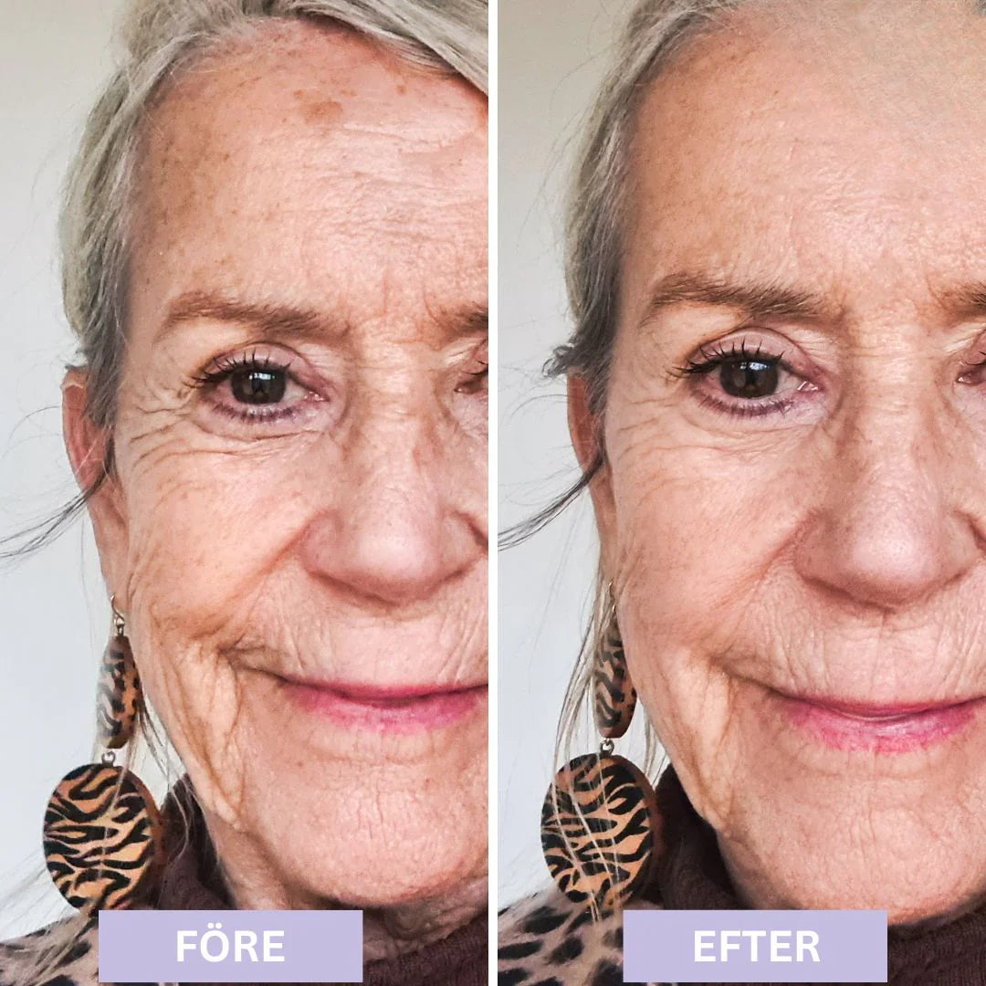 93% såg yngre hud och fick tillbaka komplimangerna de trodde var borta – Luméra™ dämpar rynkor och suddar porer på sekunder.