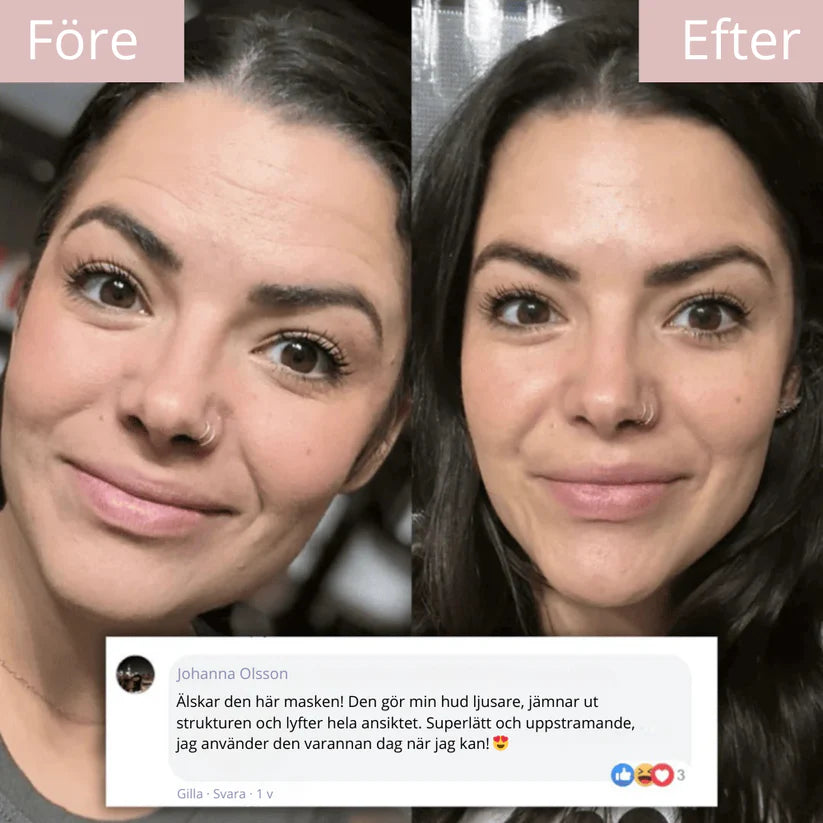 93% vaknade yngre redan första natten – Glowtox™: Mirakelmasken som säljer slut varje vecka.