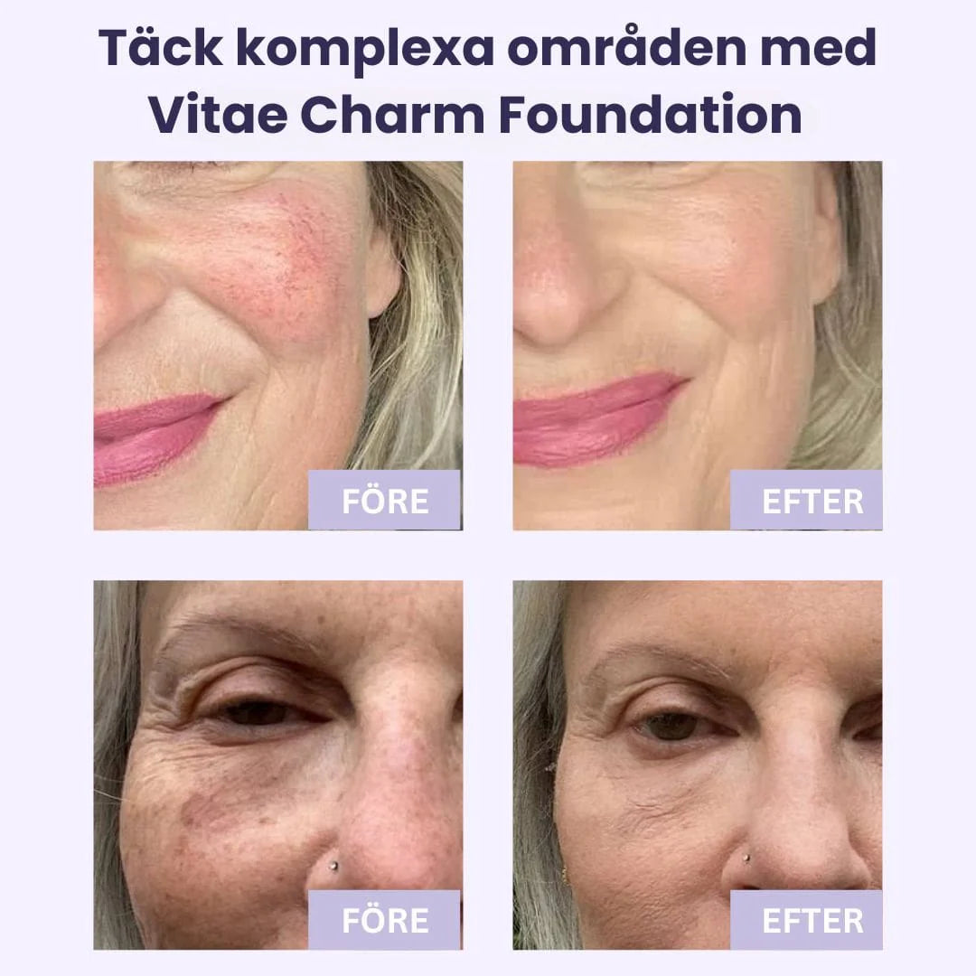 93% såg yngre hud och fick tillbaka komplimangerna de trodde var borta – Luméra™ dämpar rynkor och suddar porer på sekunder.