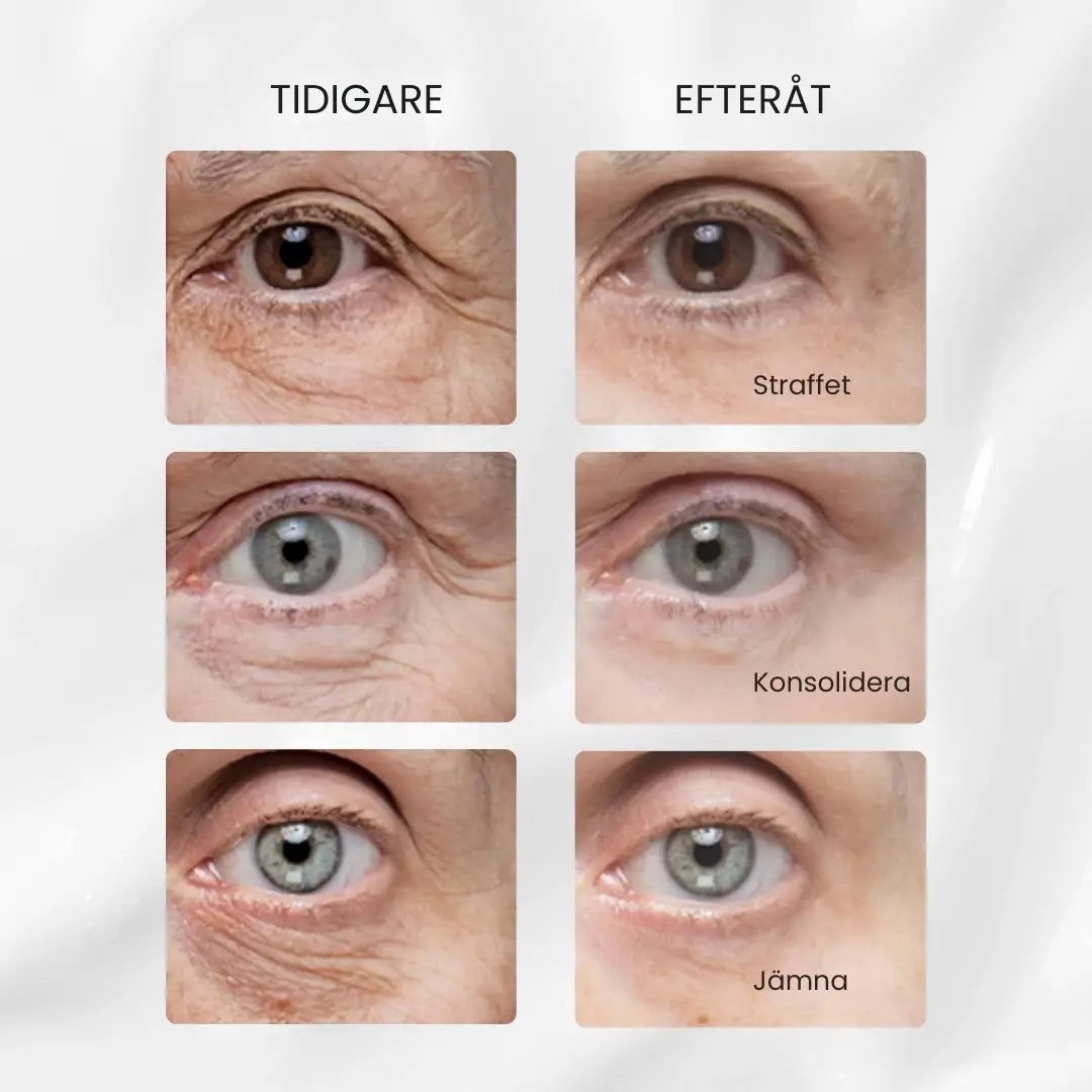 V-Lift ögonkräm – 10 år yngre på mindre än 7 minuter.  Se omedelbart fastare ut.