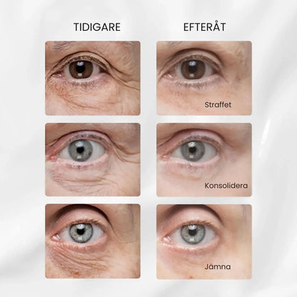 V-Lift ögonkräm – 10 år yngre på mindre än 7 minuter.  Se omedelbart fastare ut.