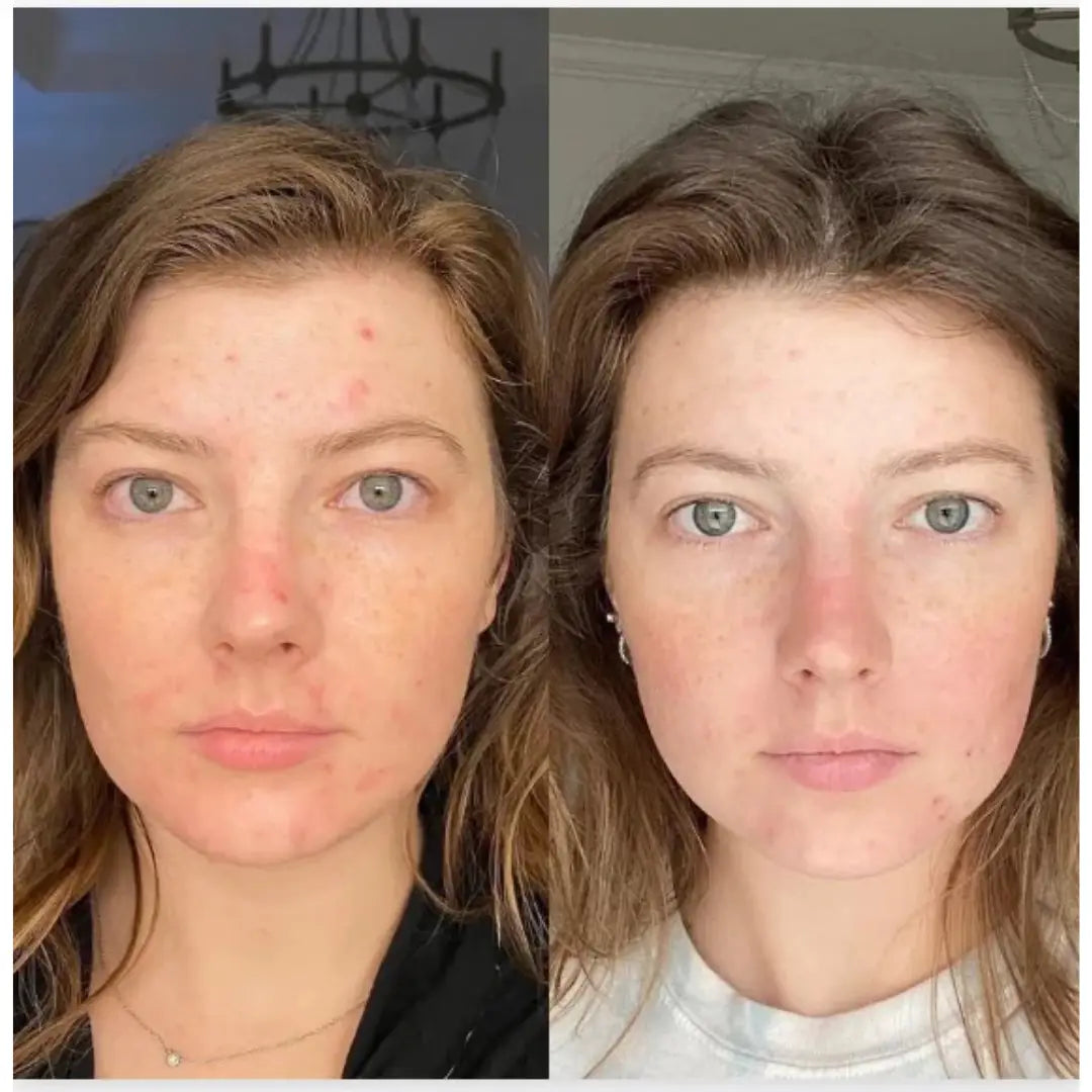 93% såg 10 år yngre hud på bara 14 dagar – Tack vare retinal liposomer som konkurrenterna inte vill att du ska känna till.