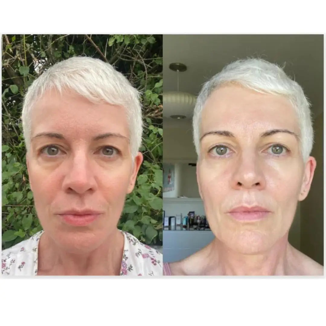 93% såg 10 år yngre hud på bara 14 dagar – Tack vare retinal liposomer som konkurrenterna inte vill att du ska känna till.