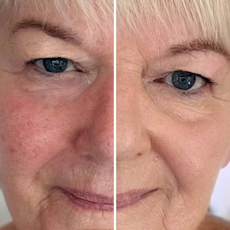 93% såg yngre hud och fick tillbaka komplimangerna de trodde var borta – Luméra™ dämpar rynkor och suddar porer på sekunder.