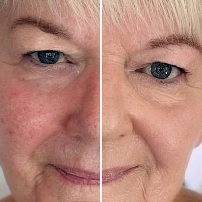 93% såg yngre hud och fick tillbaka komplimangerna de trodde var borta – Luméra™ dämpar rynkor och suddar porer på sekunder.