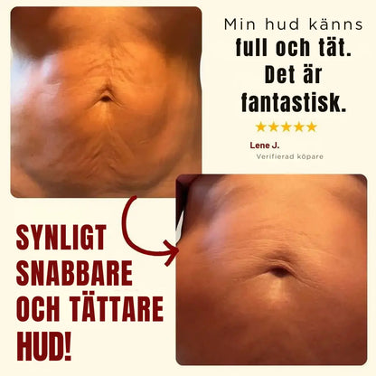 HudElixir™ – Stramar upp och återfuktar huden för ett ungdomligt, strålande utseende – med upp till 90% förbättring på bara några veckor.