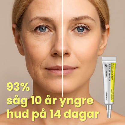 93% såg 10 år yngre hud på bara 14 dagar – Tack vare retinal liposomer som konkurrenterna inte vill att du ska känna till.