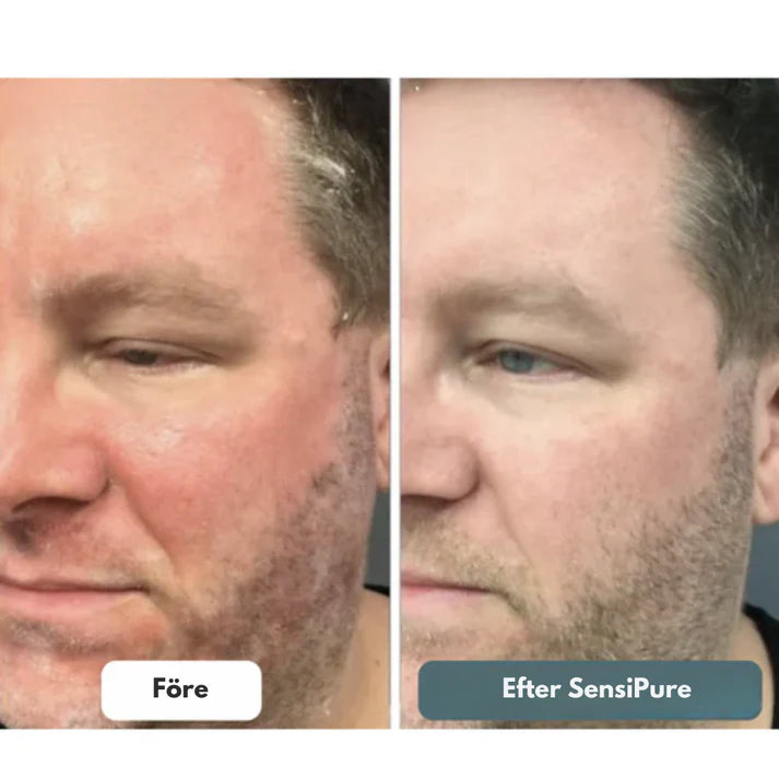 SensiPure Kräm - Lugnare hud, bättre känsla och mer självförtroende i dag.